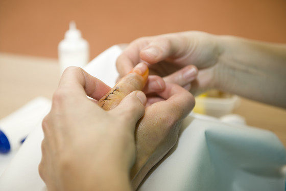 Auf Fotos wird die Hand von einem Patienten behandelt Auf Fotos wird die Hand von einem Patienten behandelt
